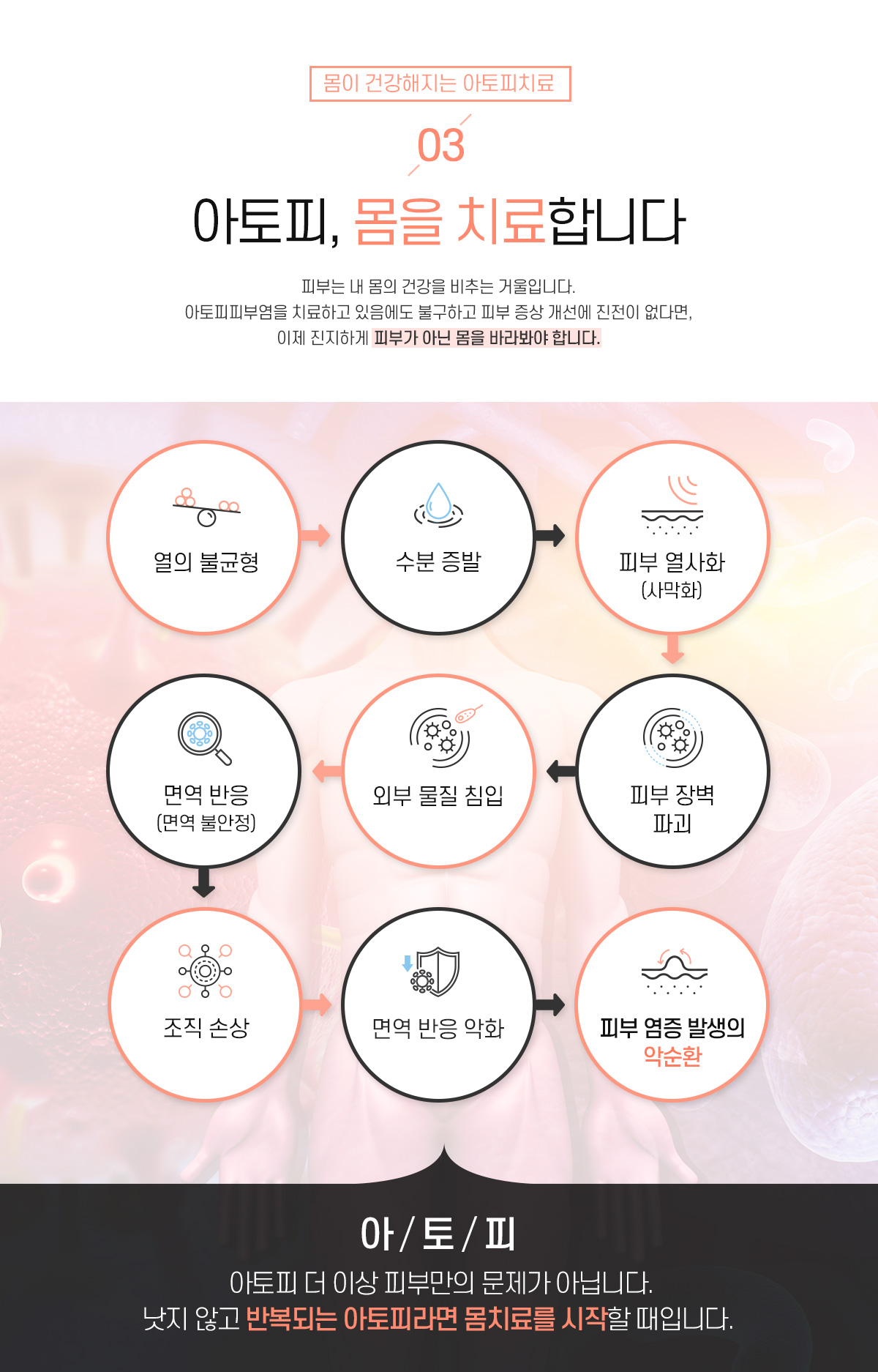 3. 아토피, 몸을 치료합니다