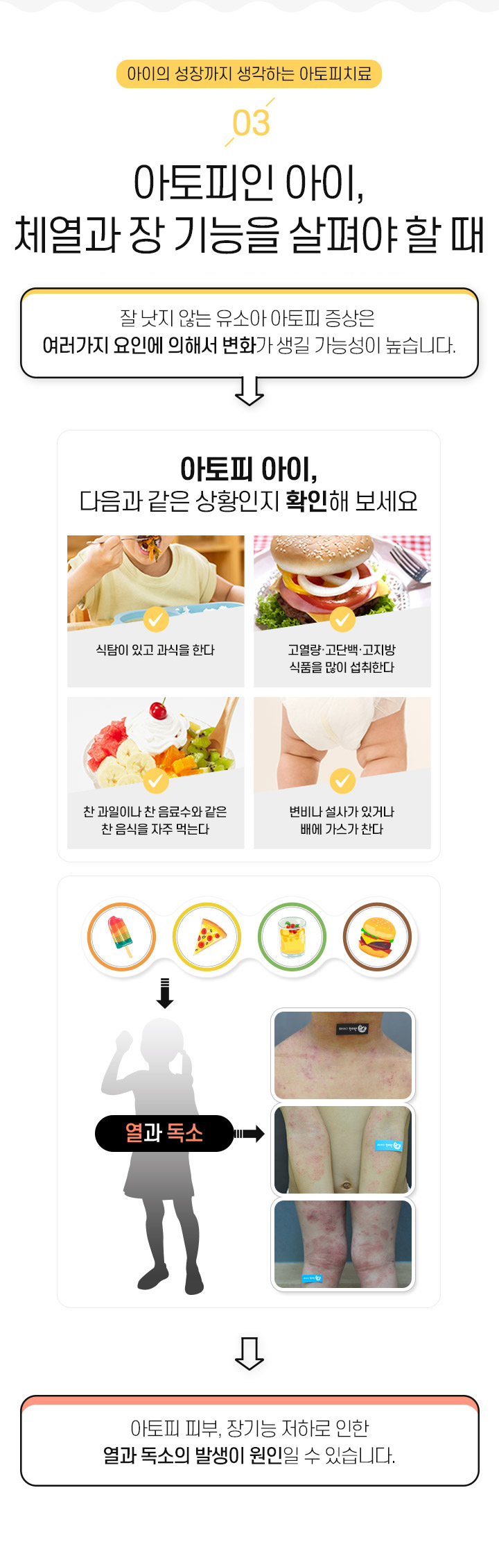 3. 아토피인 아이, 체열과 장 기능을 살펴야 할 때
