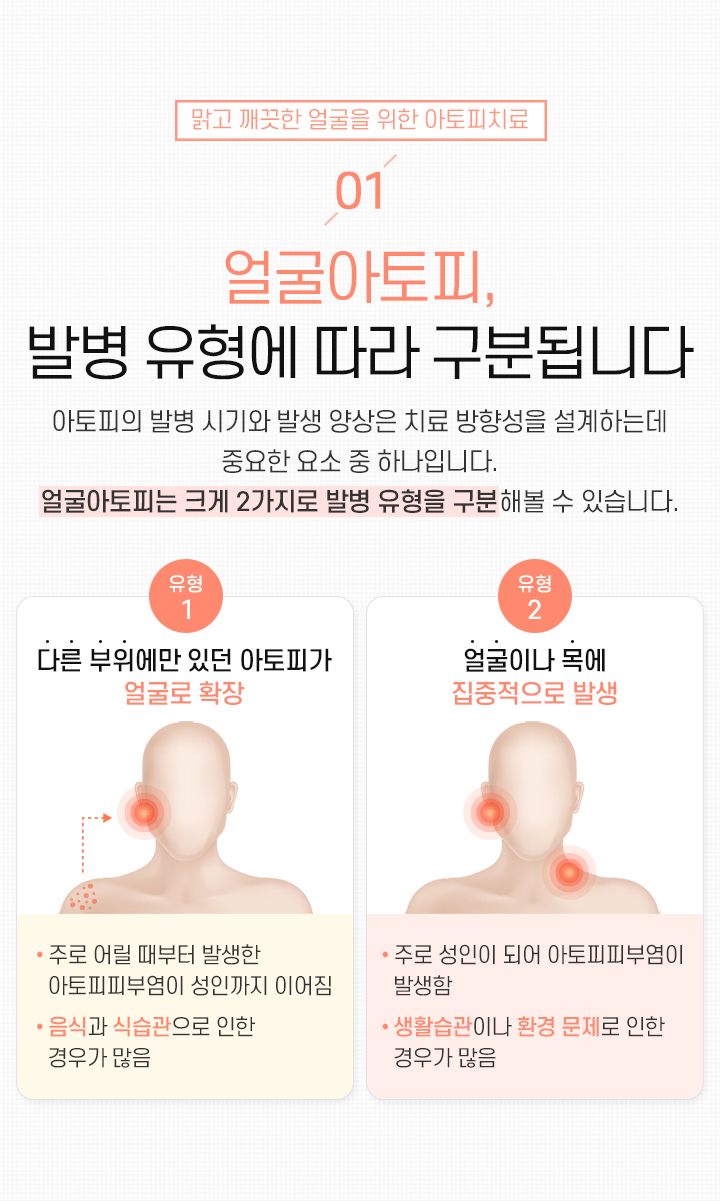1. 얼굴아토피, 발병 유형에 따라 구분됩니다