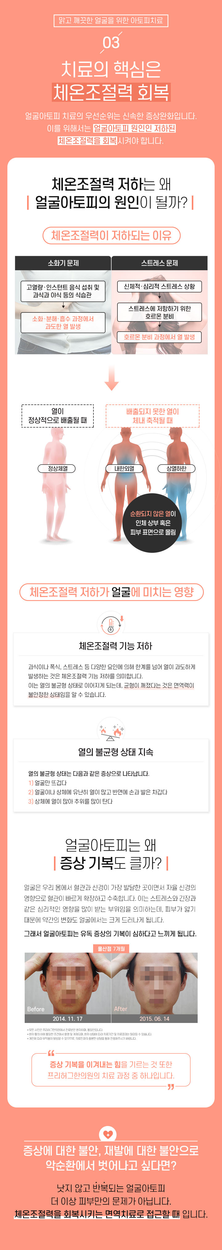 3. 치료의 핵심은 체온조절력 회복