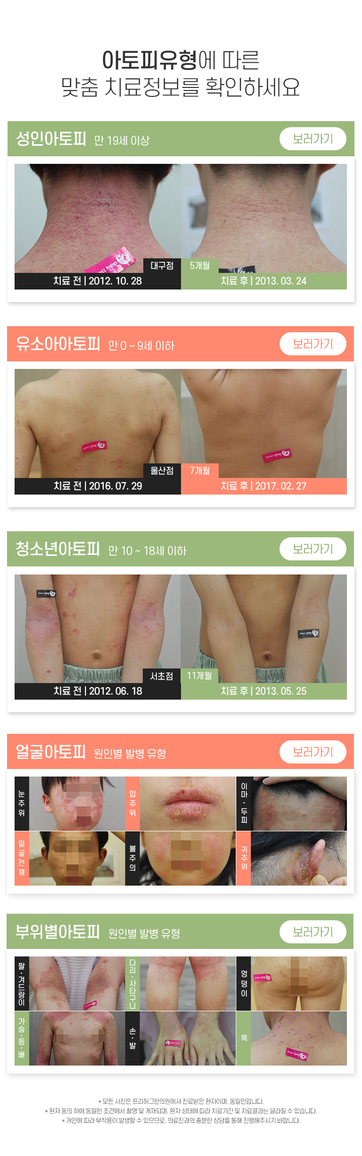 아토피 유형에 따른 맞춤 치료정보