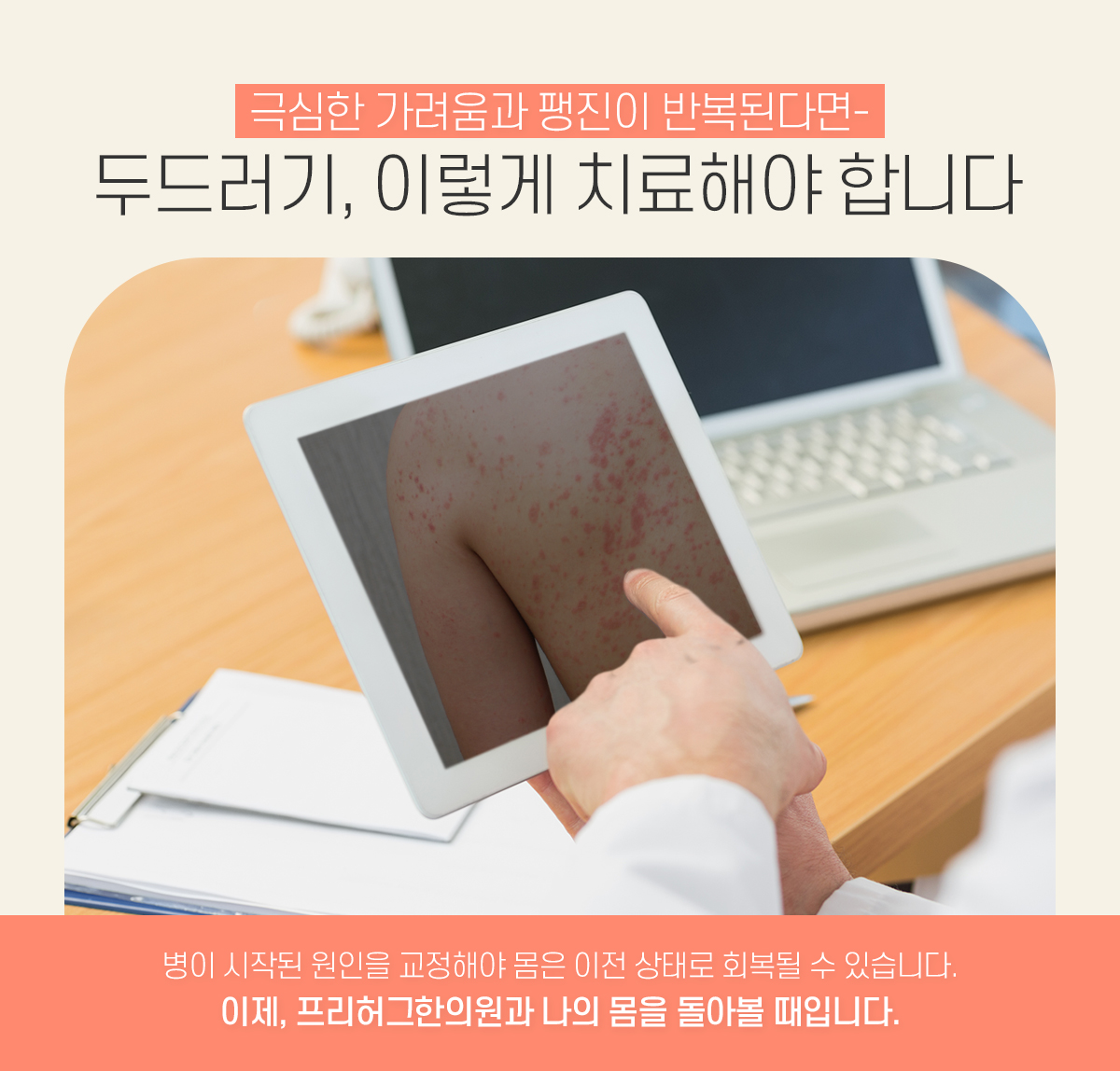 두드러기, 이렇게 치료해야 합니다