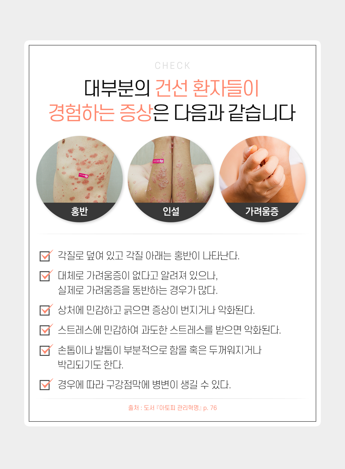 대부분의 건선 환자들이 경험하는 증상은 다음과 같습니다