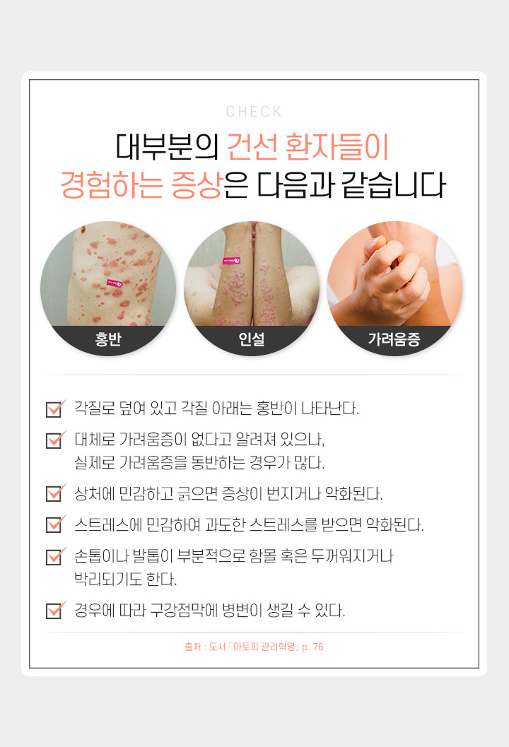 대부분의 건선 환자들이 경험하는 증상은 다음과 같습니다
