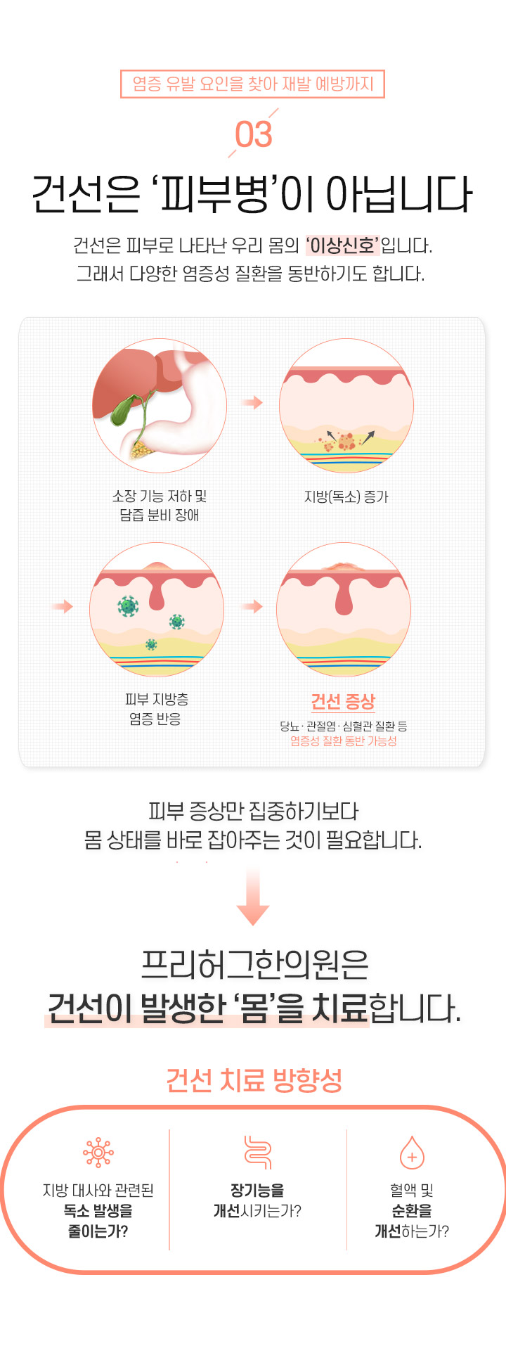 3. 건선은 피부병이 아닙니다
