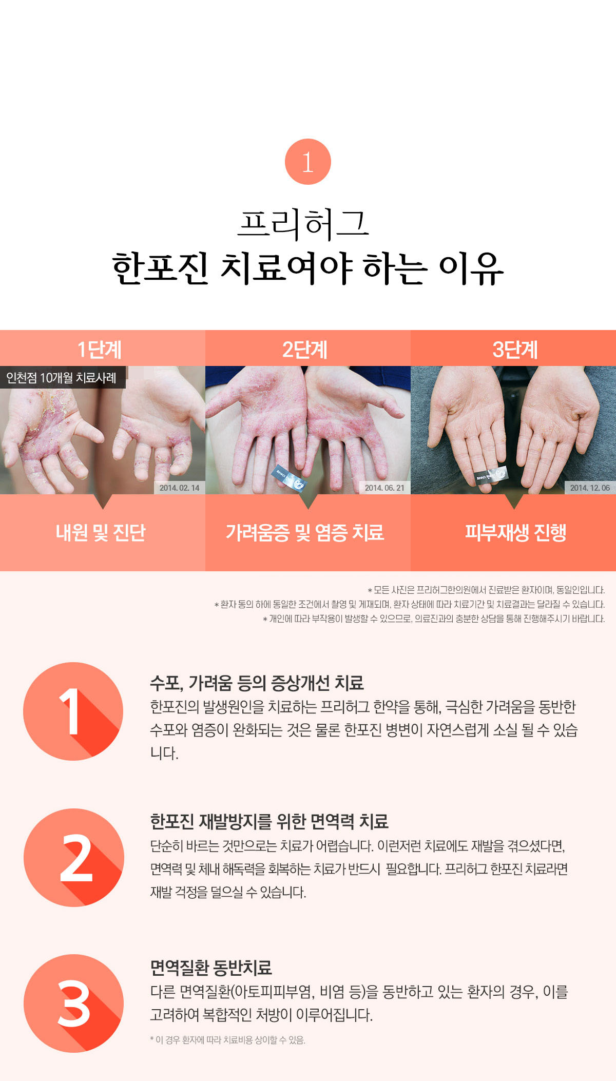 프리허그 한포진 치료여야 하는 이유