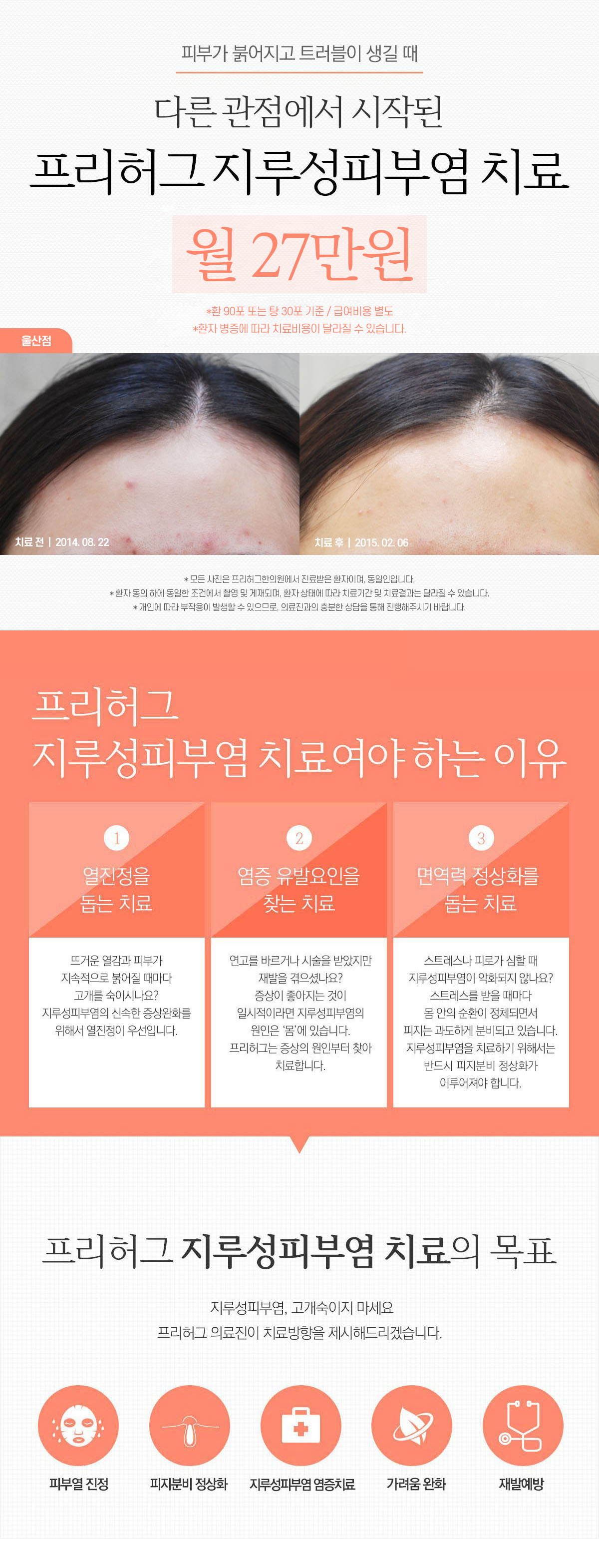 프리허그 지루성피부염 치료